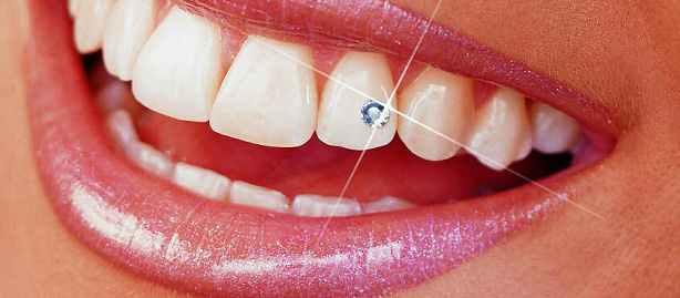 Tooth Jewellery Cosmetic Category Card