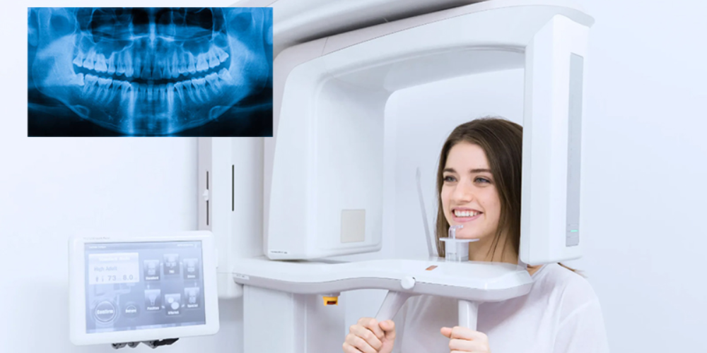 OPG Panoramic Digital X-Ray Scan machine architecture