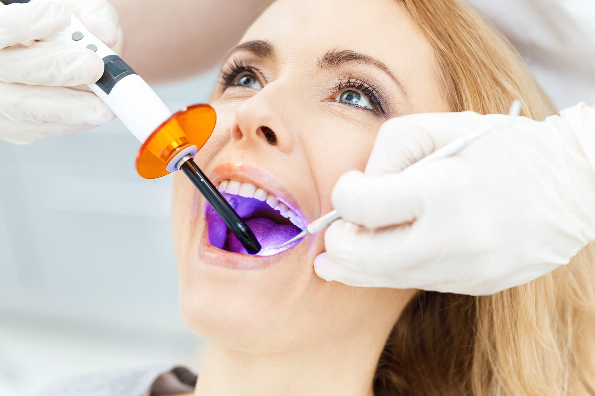 Cosmetic Laser teeth whitening activate chemical enamel gel procedure setup photo